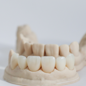 Couronne Full Zircone