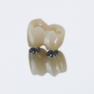 Full Zircone Transvissée