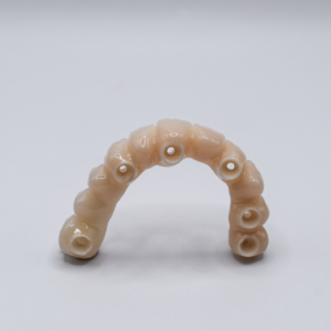 Couronne scellée/ transvissée