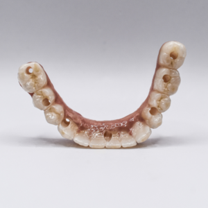 Full arche Zircone