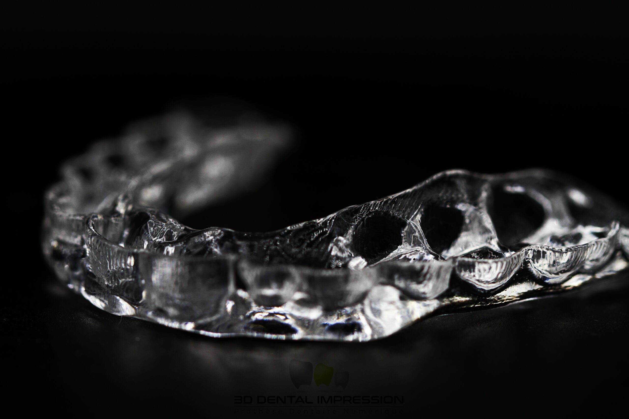 Gouttière De Contention Laboratoire 3D Dental Impression