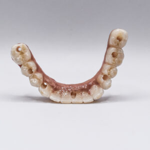 Pilotis full zircone fausse gencive