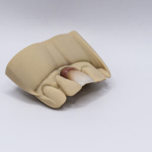 Céramo Céramique Micro Stratifiée