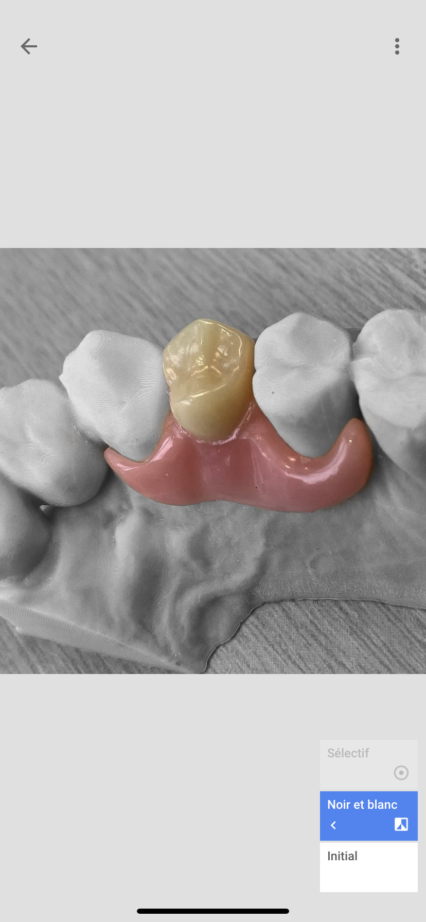 60 Coussinets En Mousse Dentaire 4mm - Pour Résine Composite, Optrasculpt, Neuf