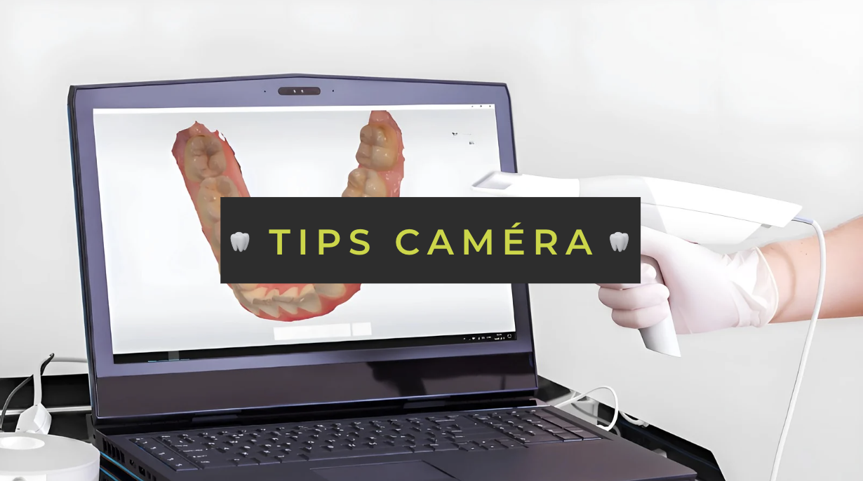 Tips Caméra