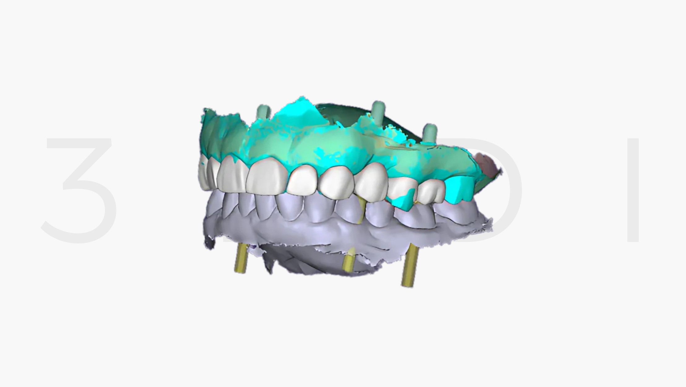 Digital Smile Design – DSD