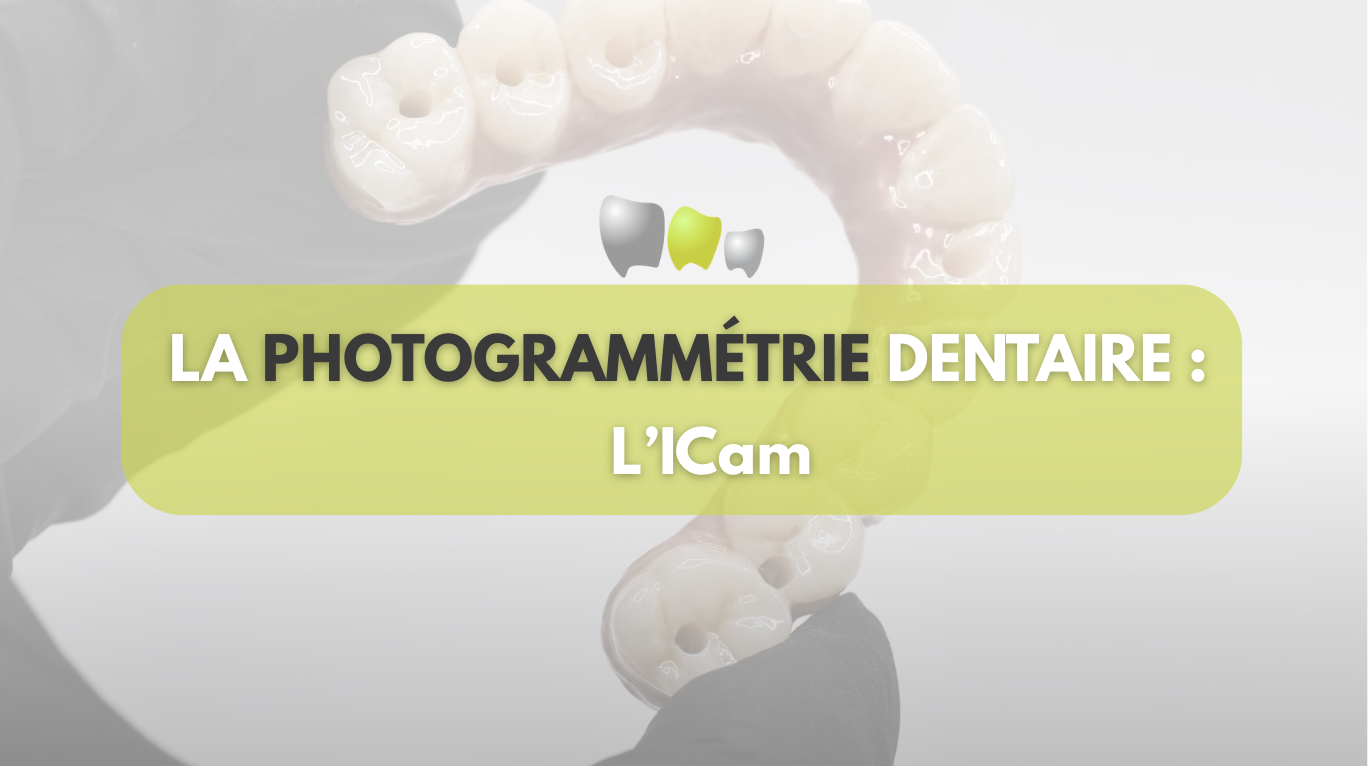 La Photogrammétrie dentaire : l&rsquo;ICam