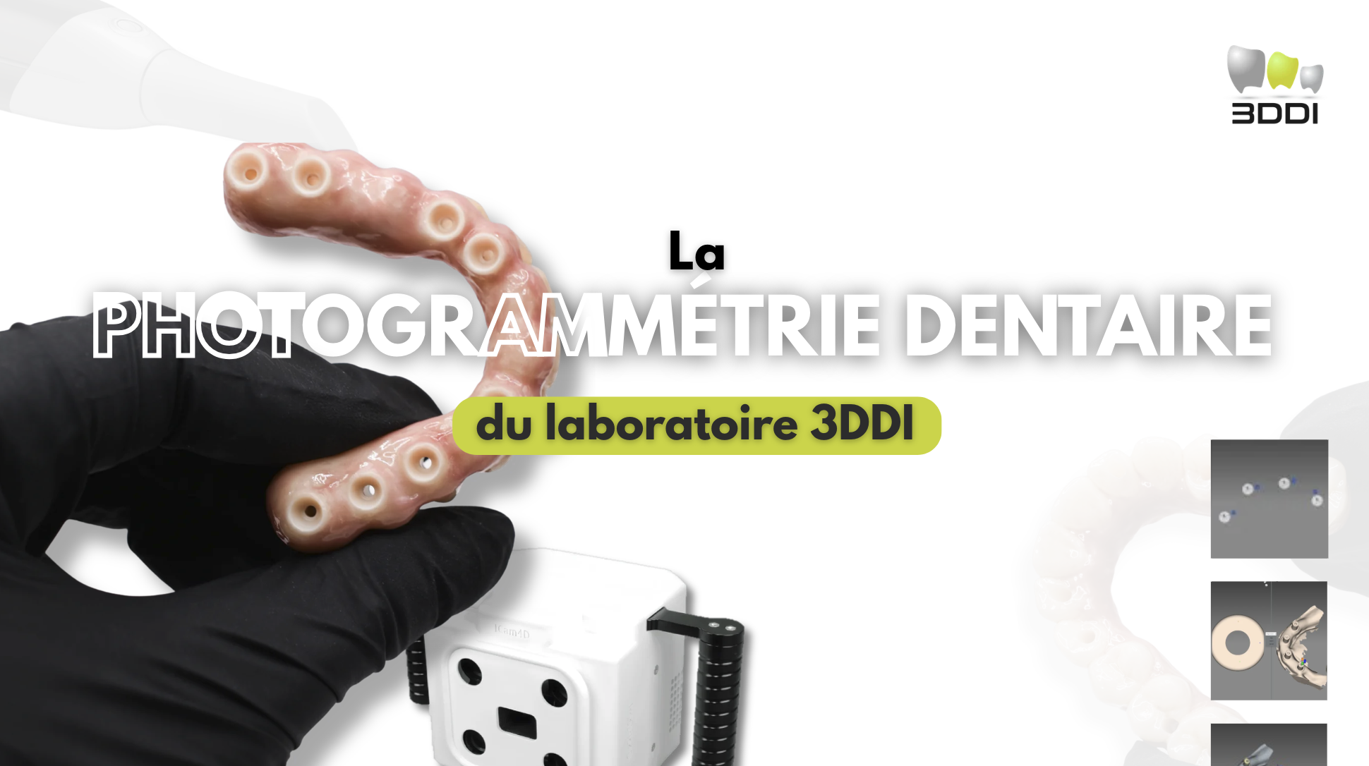La Photogrammétrie dentaire
